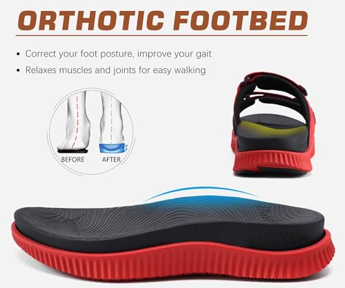KuaiLu Men's Orthotic Sandals Athletic Recovery Slides with Arch Support Q91398