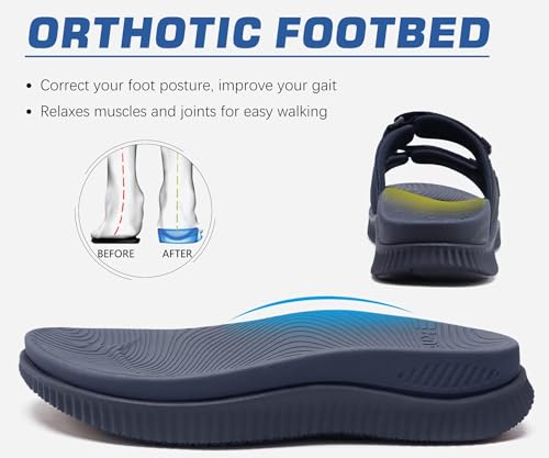 KuaiLu Men's Orthotic Sandals Athletic Recovery Slides with Arch Support Q91398